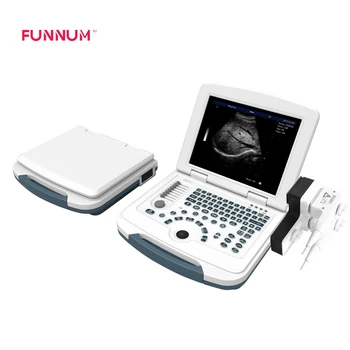 prenosni barvni doppler ultrazvok skener, barvni doppler ultrazvok skener